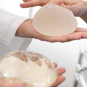 Implantate an der Këscht