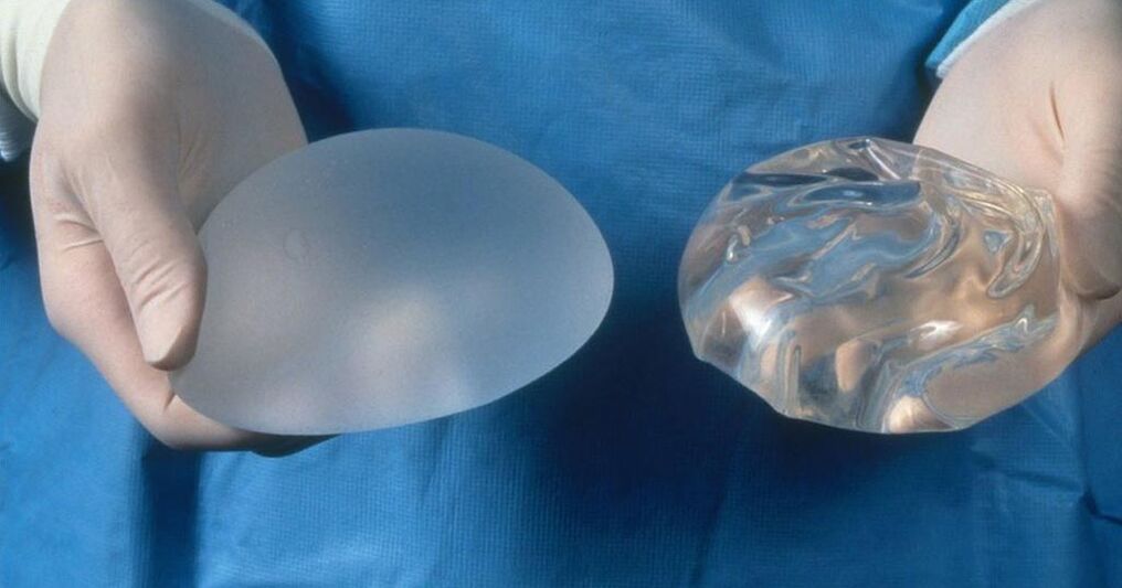 implantant