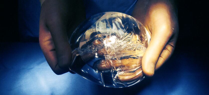 Silikon Endoprothese